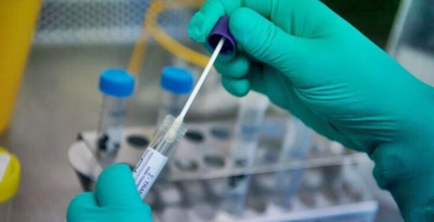 Gümüşhane’de yapılamaması nedeniyle Kovid-19’la ilgili testler bugüne kadar Trabzon başta