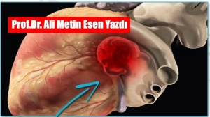 PROF.DR. ALİ METİN ESEN YAZDI Kalp tümörleri, kalp veya kalp
