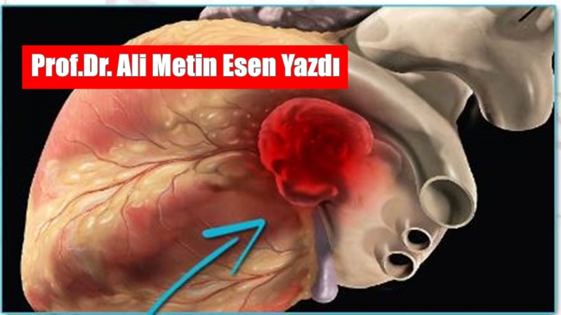 PROF.DR. ALİ METİN ESEN YAZDI Kalp tümörleri, kalp veya kalp