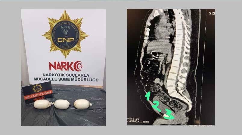 İran uyruklu şahsın iç beden muayenesinde 271,55 gram metamfematin ele